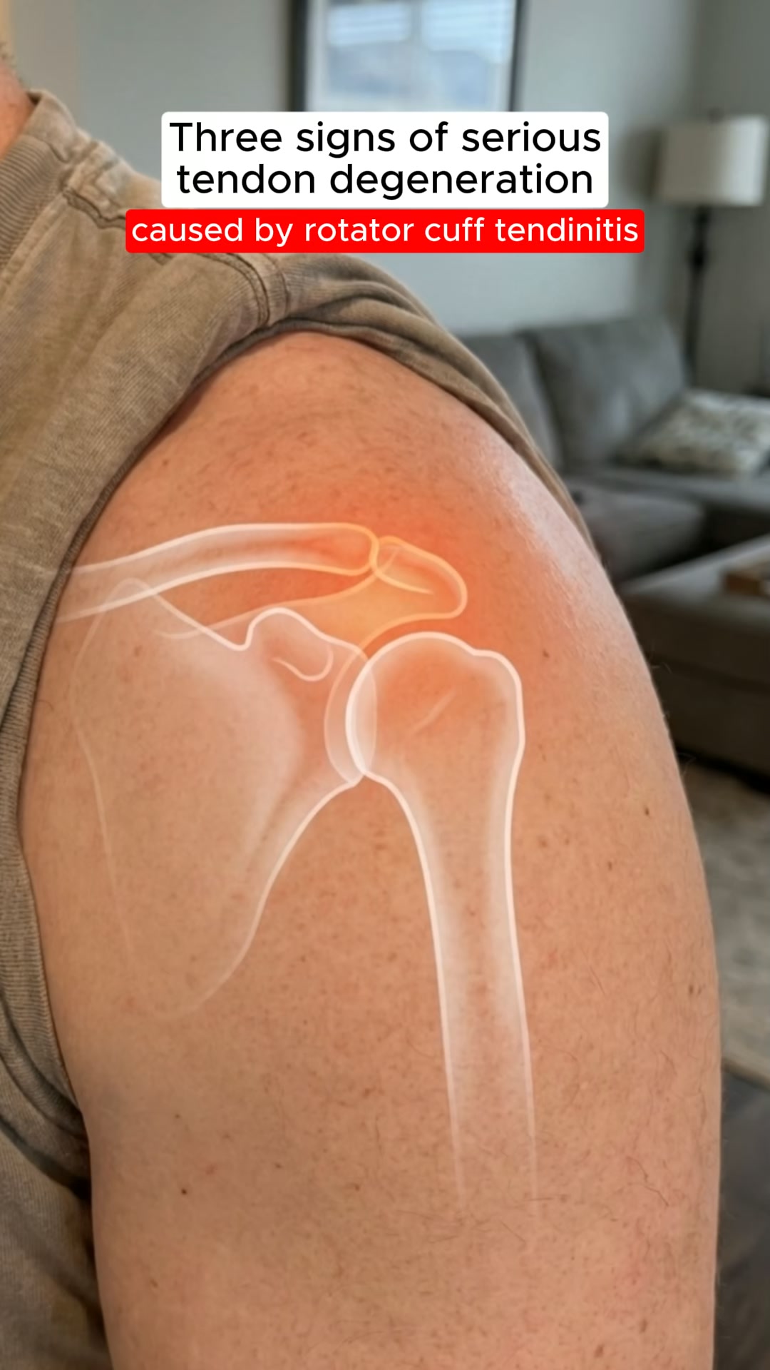 The Easiest Shoulder Relief Ever. [On Sale Today]