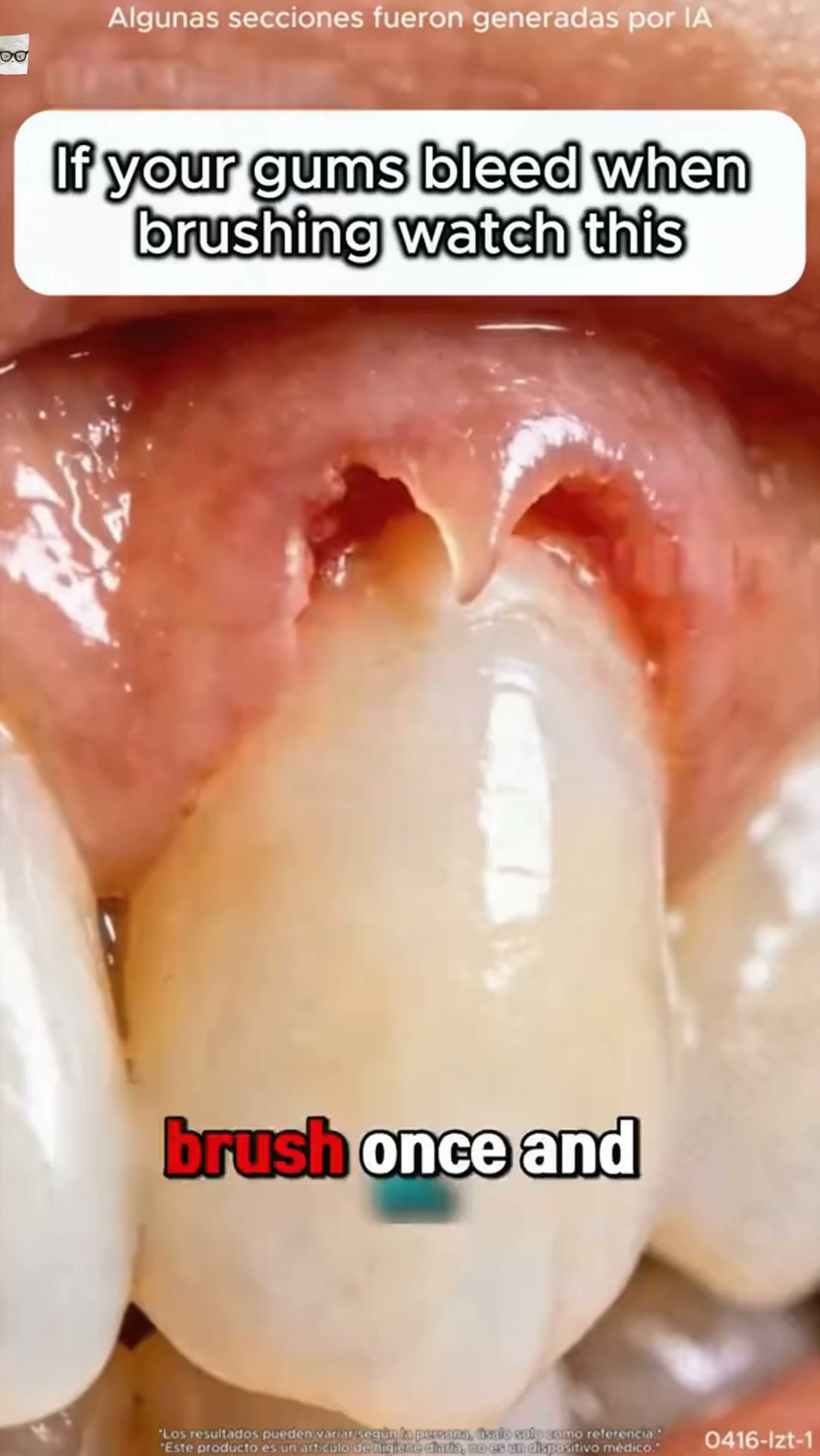 Hot, Cold, Acidic? Eat Fearlessly Again!