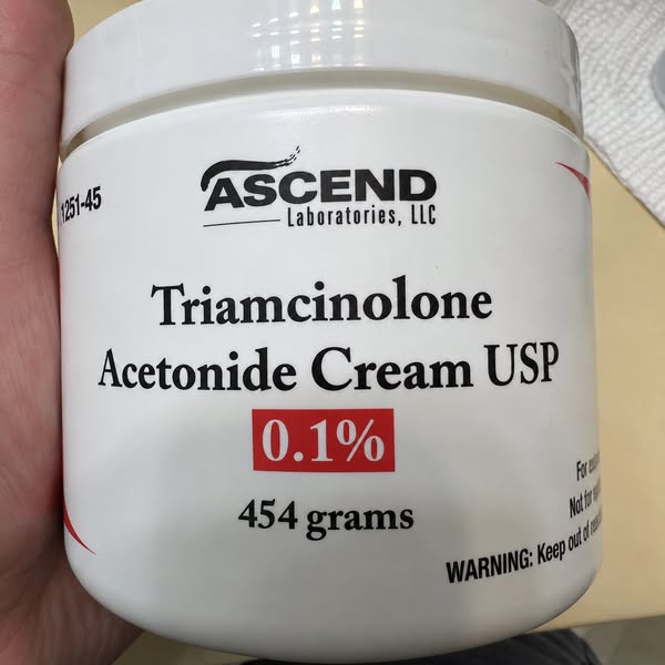 read this if you considered steroid cremes
