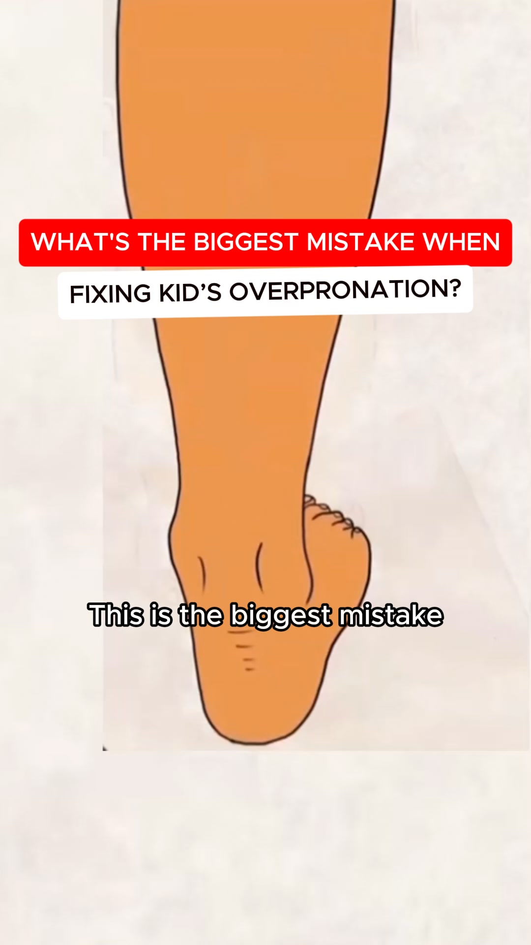 Support Flat Feet the Right Way