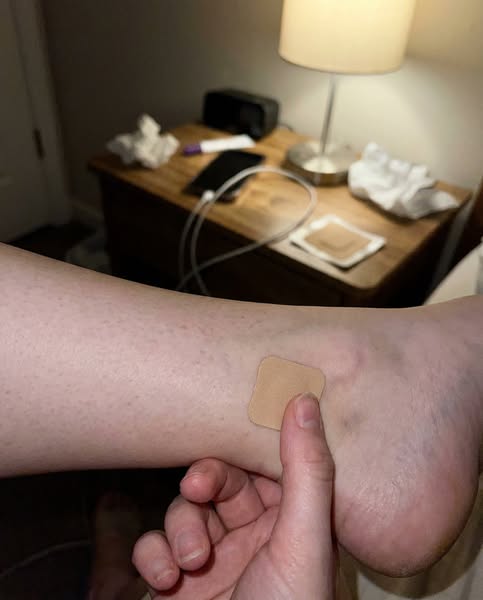 Fix Neuropathy Naturally