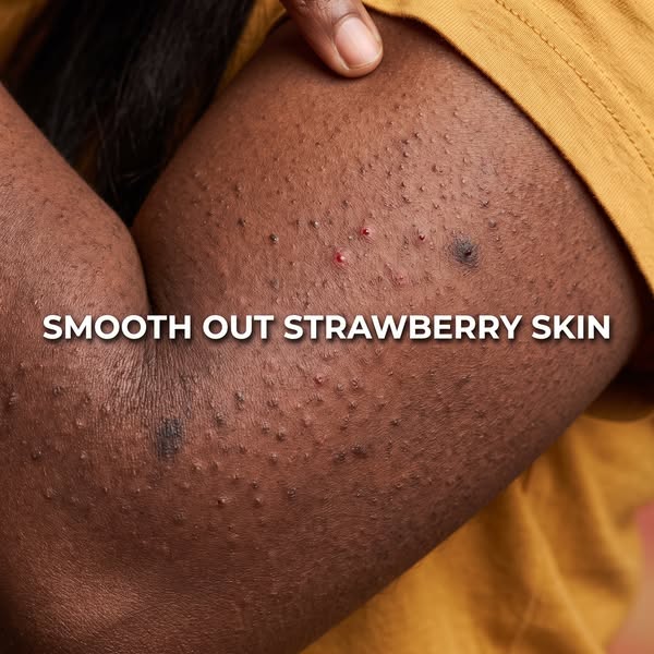 How to smooth out strawberry skin!