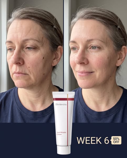 Reveal smoother, firmer, more rejuvenated skin — all in one powerful anti-aging cream.
