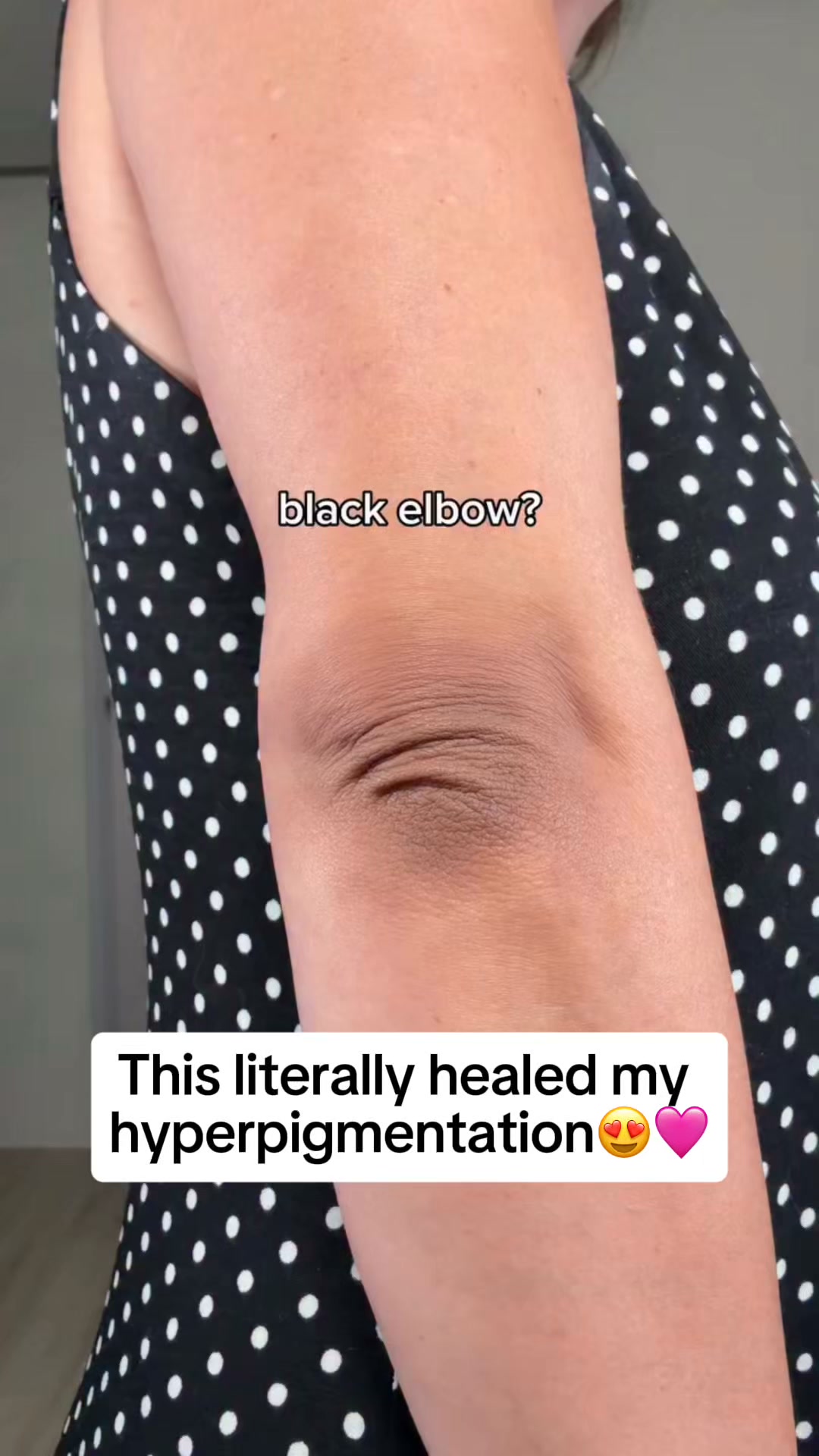 Brighter, More Even-Looking Skin