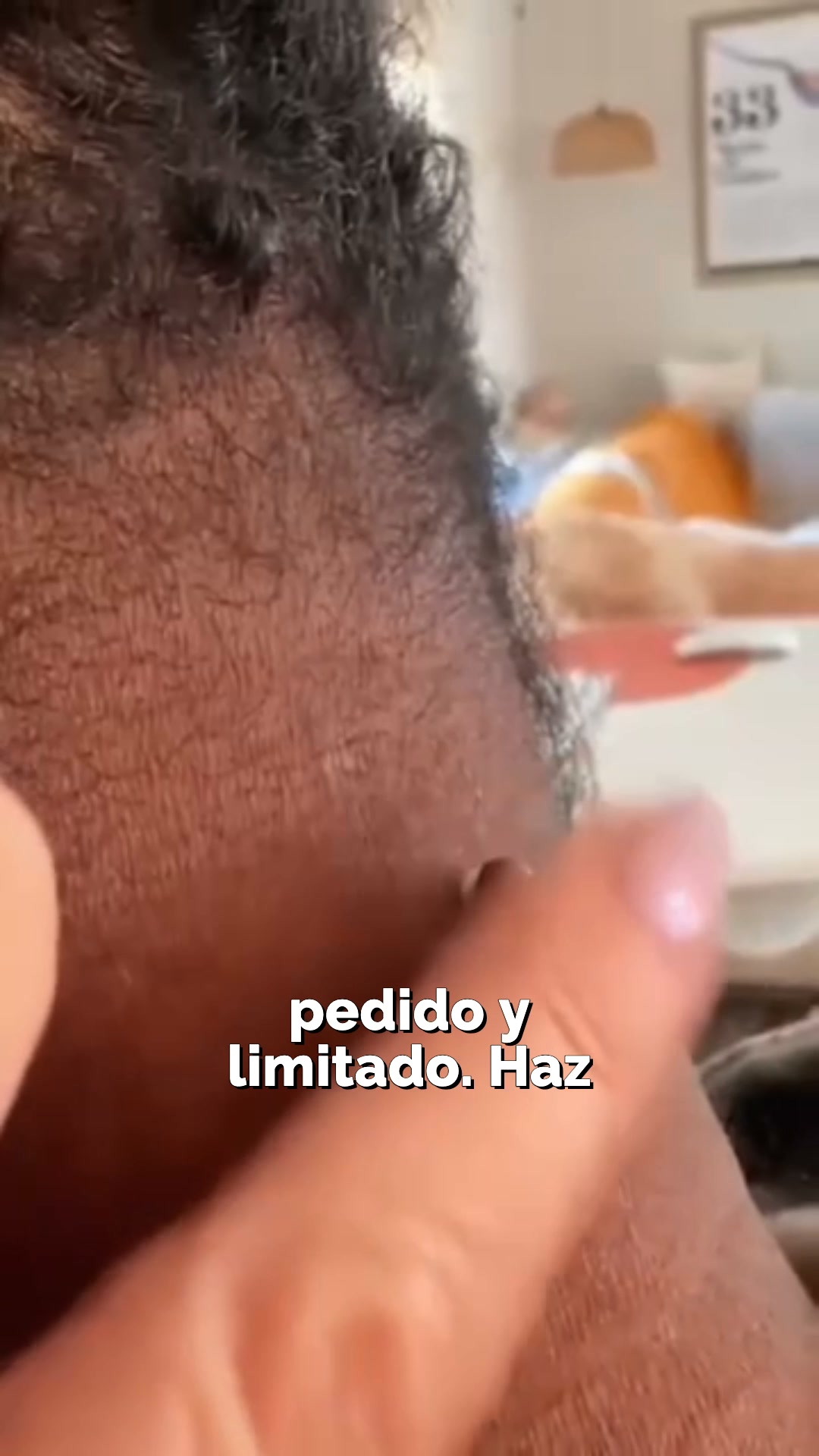 Acrocordones, fuera de tu rutina