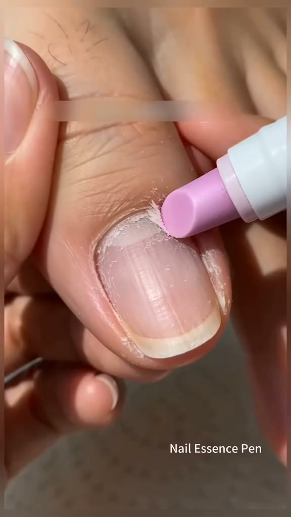 Roll Away Dry Cuticles In Seconds