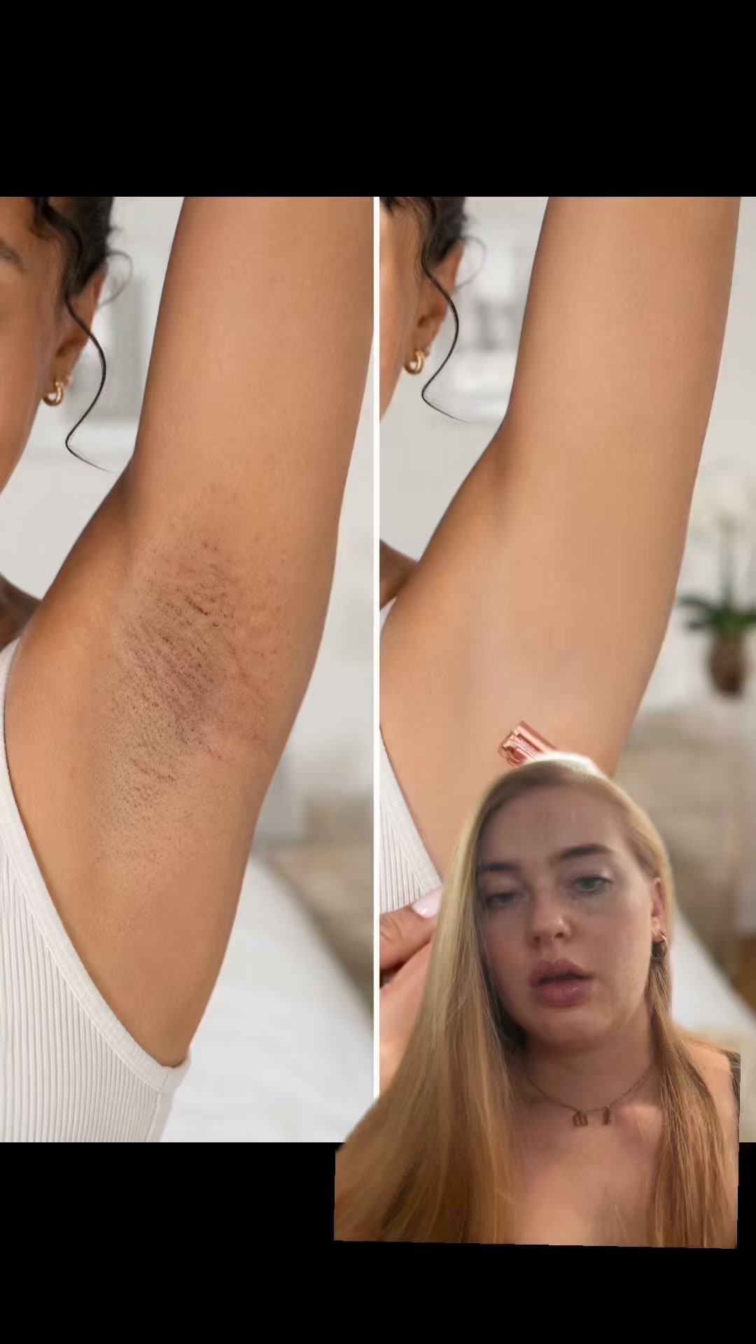 Sweat + razor rash = no way. Fix the razor.