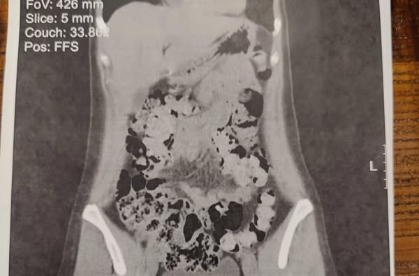 Reduce bladder leaks — naturally