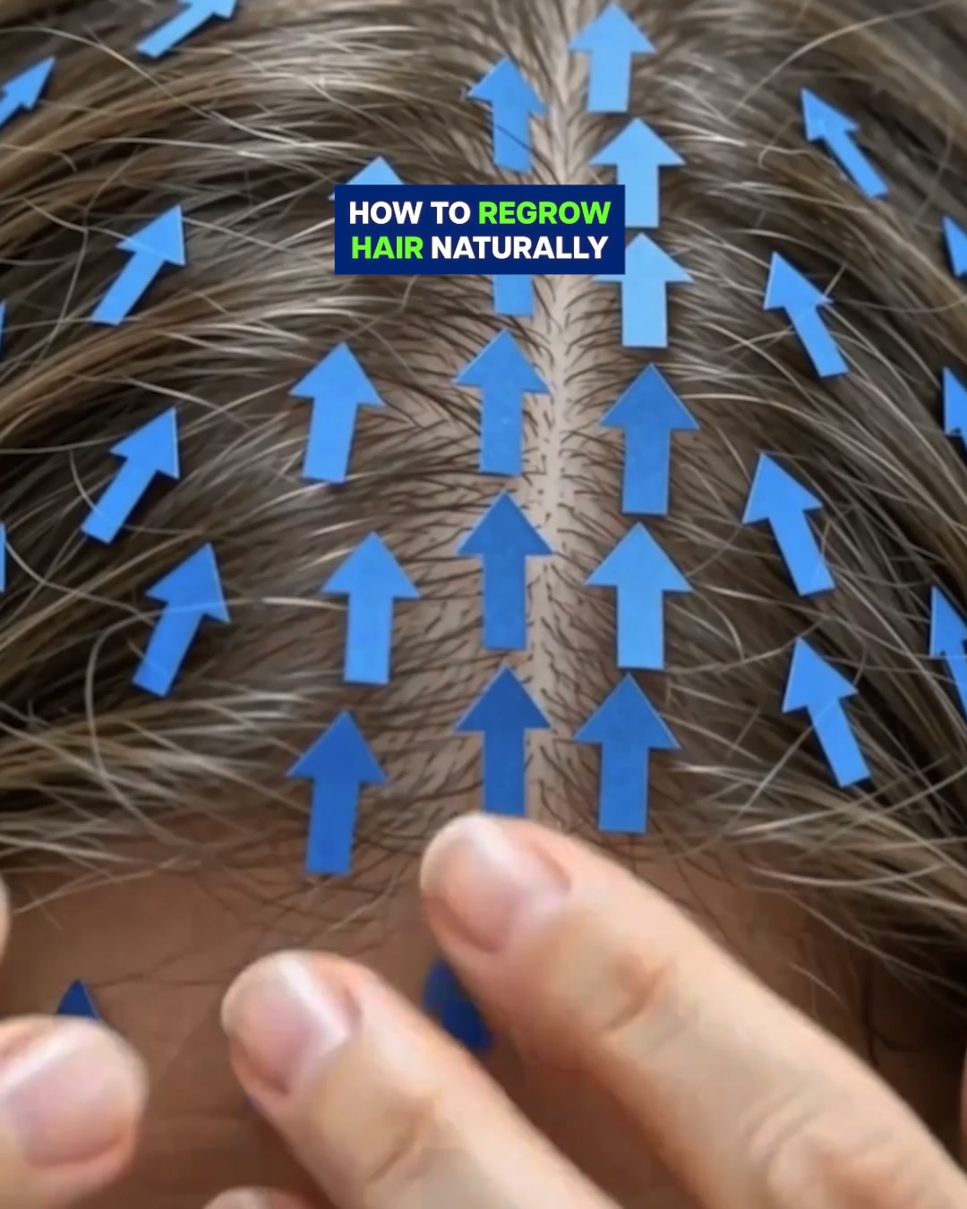The Scalp Problem That Could Be Affecting Your Hair