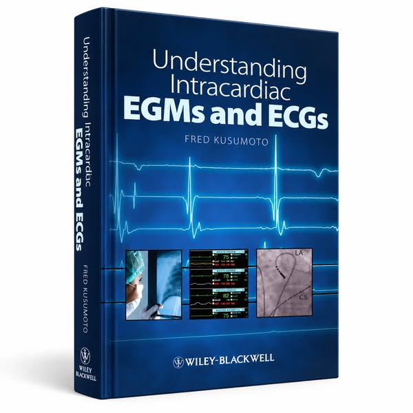 Understanding Intracardiac EGMs and ECGs (1st Edition)