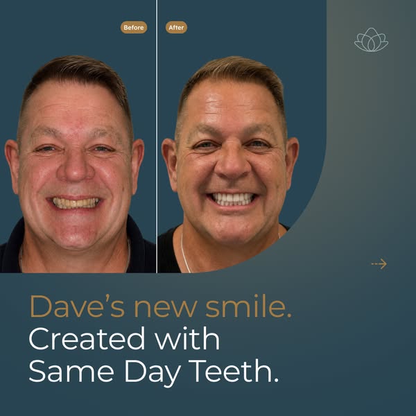 Dave's New Smile