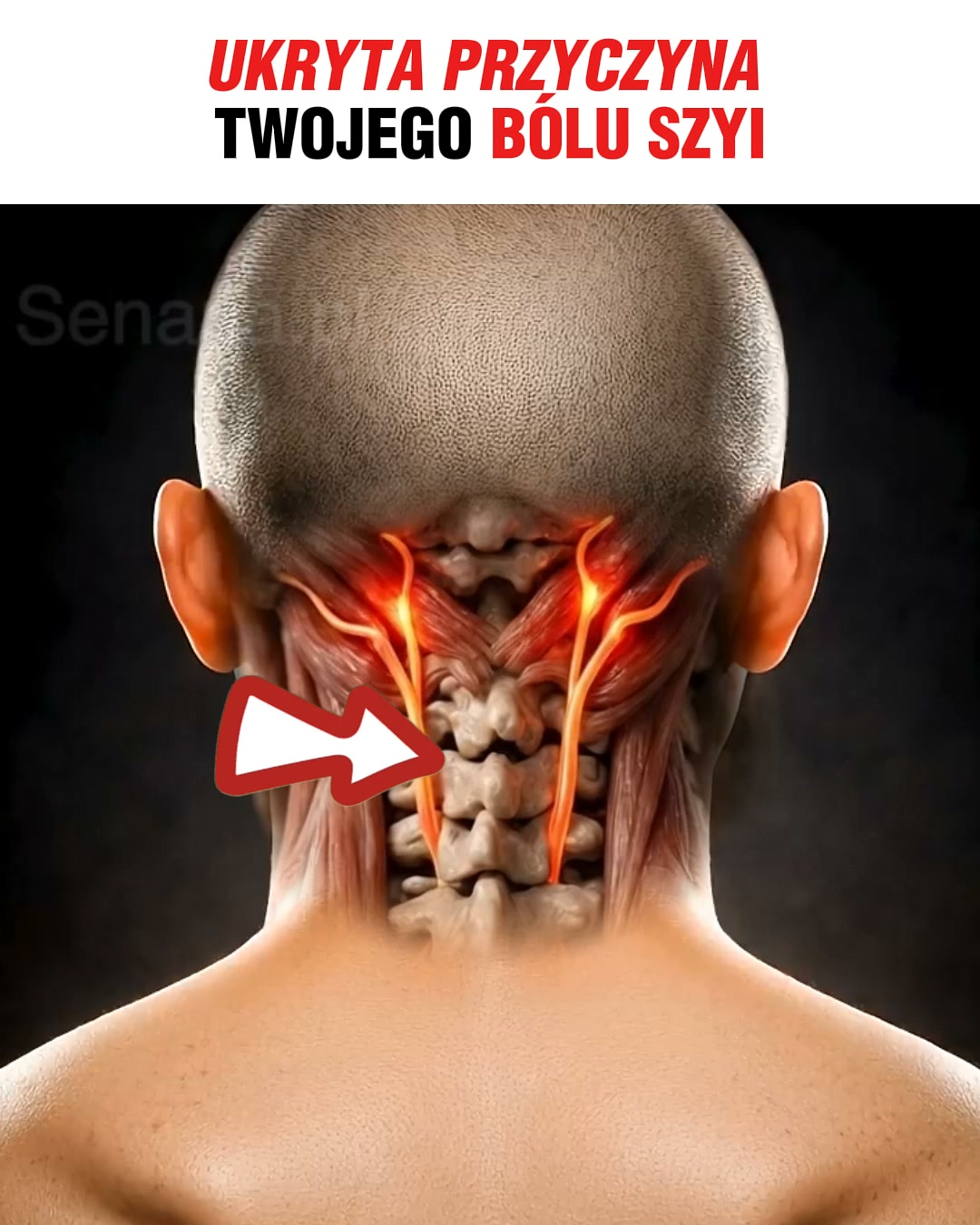 Przeczytaj, jeśli ból szyi nie ustępuje...