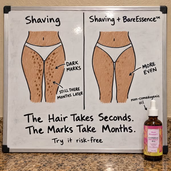 The Step After Your Razor
