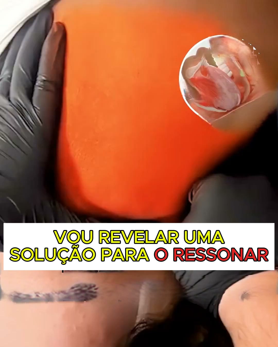 Ressonar ou Apneia do sono?