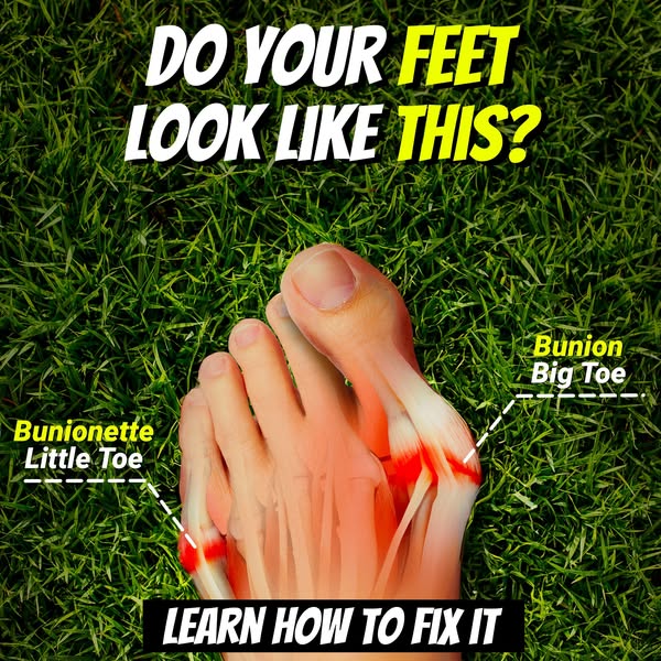 Pain-Free Feet in 60 Minutes