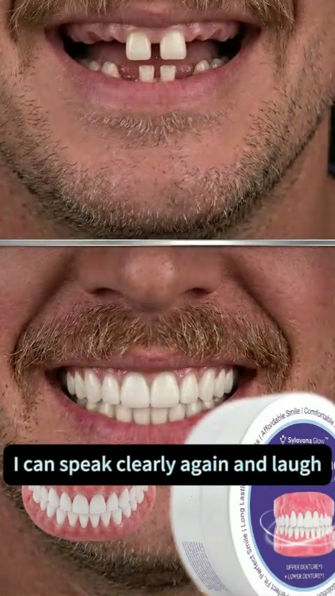 Smile with confidence in 3 minutes
