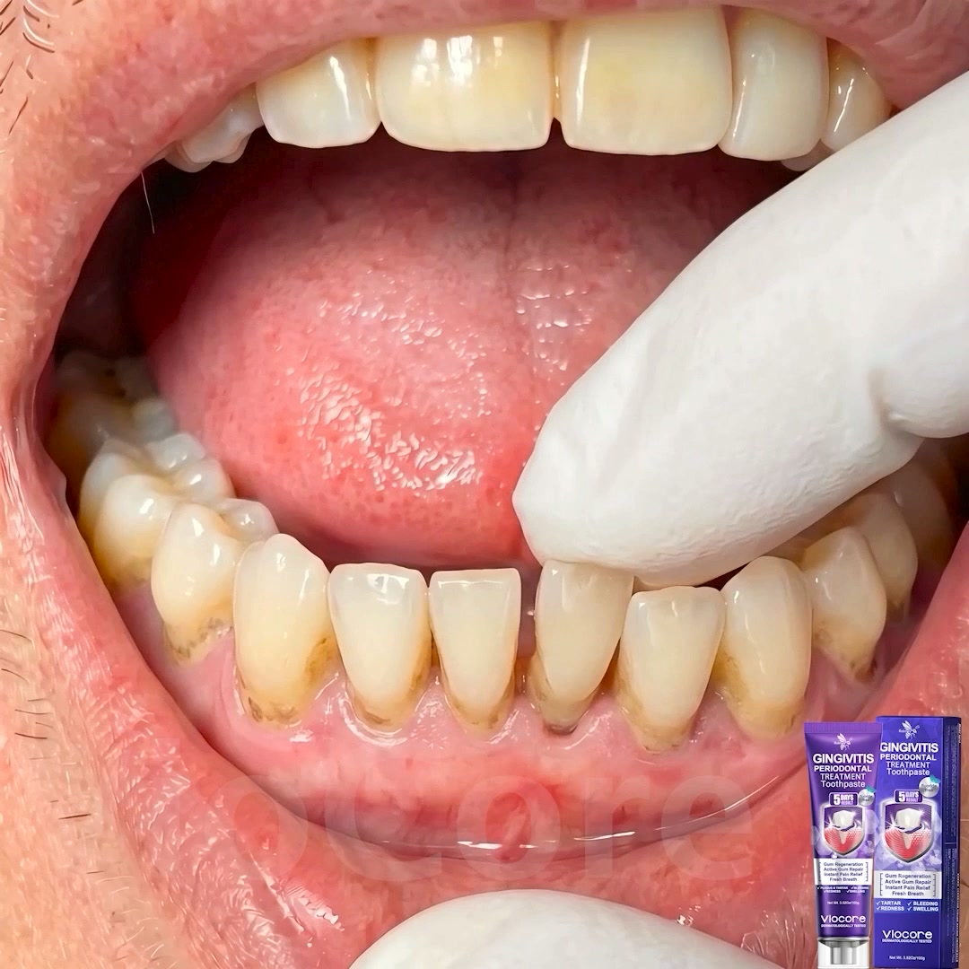 Gum Healing Endorsed by the British Dental Association (BDA) | Delivery within 2-4 working days | Full refund guarantee