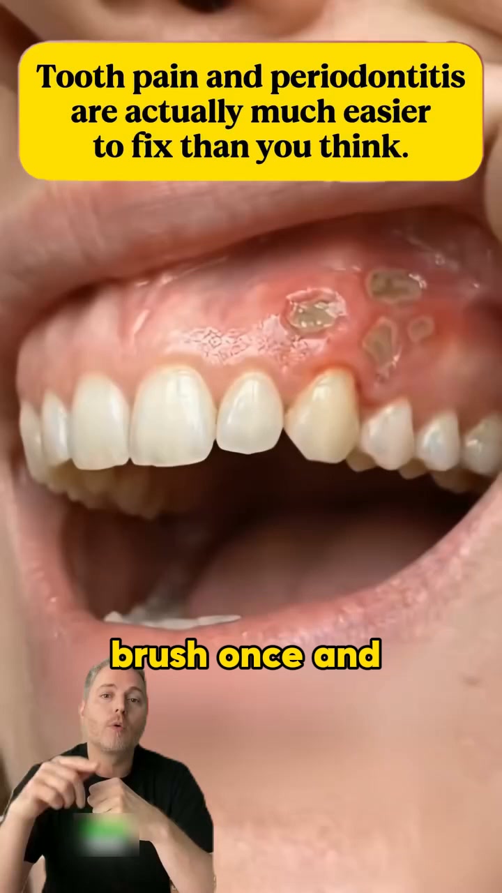 Toothpaste