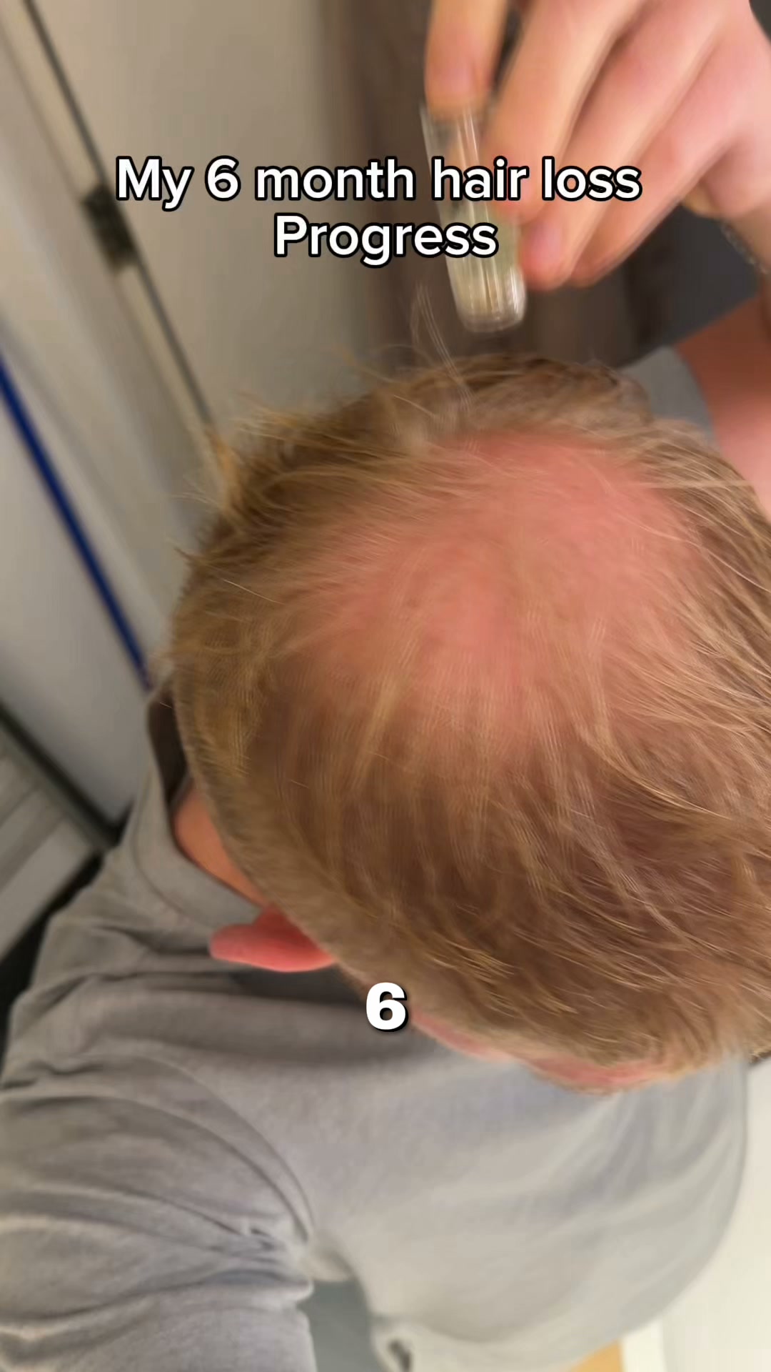Restore your hair!