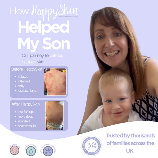 How HappySkin Helped My Son