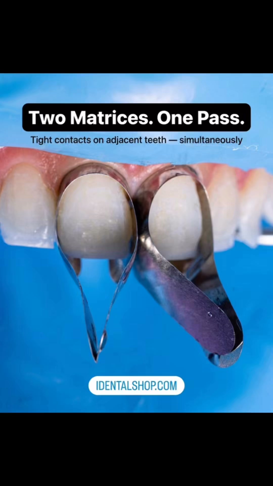 Anterior Sectional Matrices —Natural Contours. Less Finishing Time.