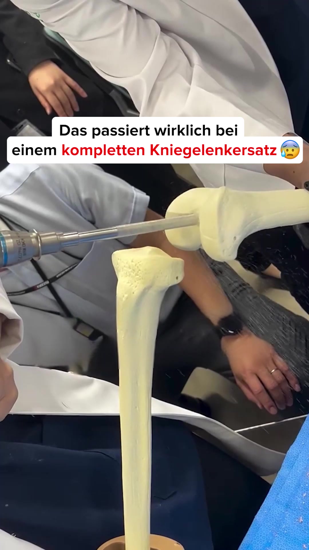 Knieschmerzen oder Arthrose?
