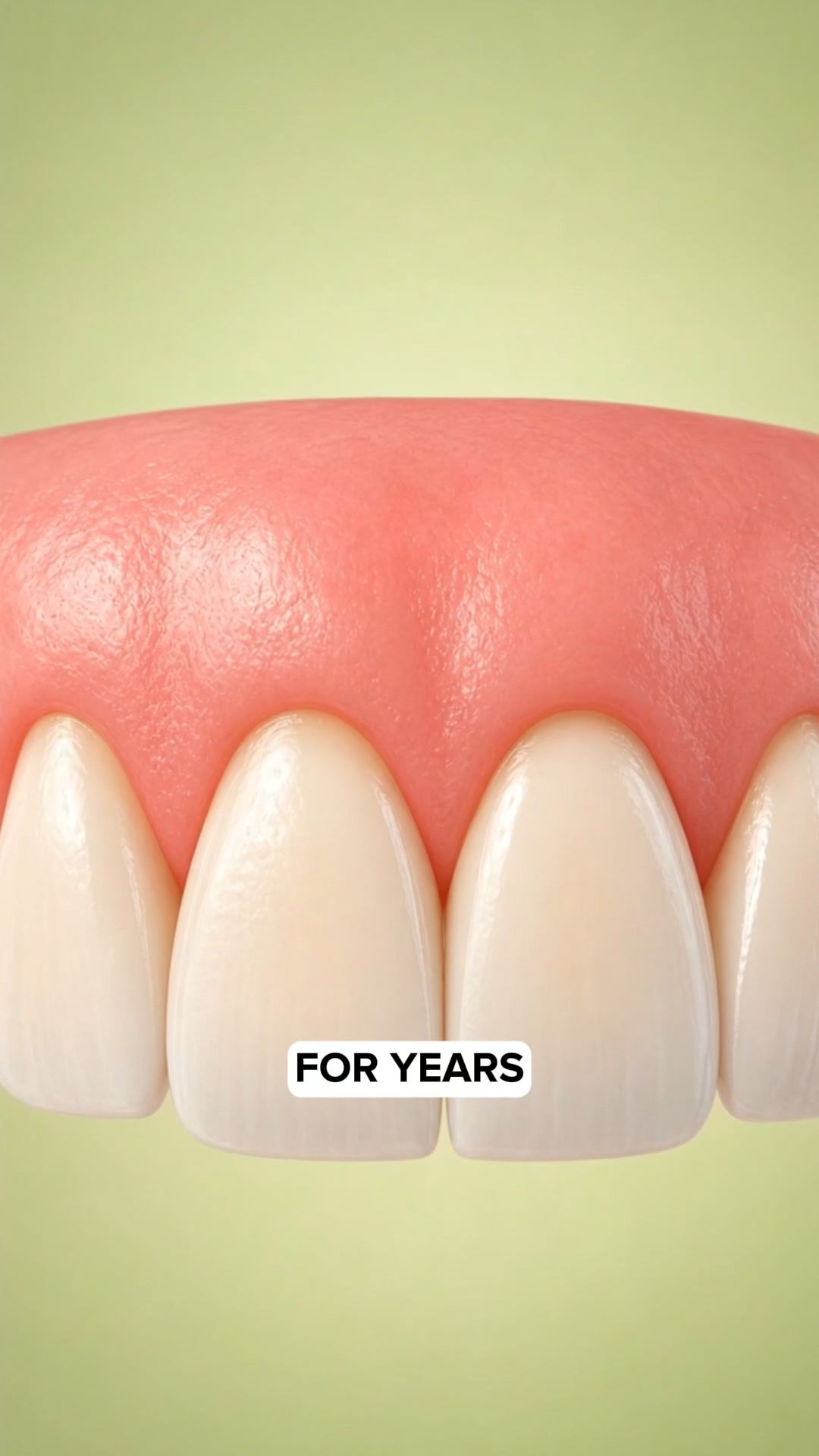 My Gums Kept Pulling Back