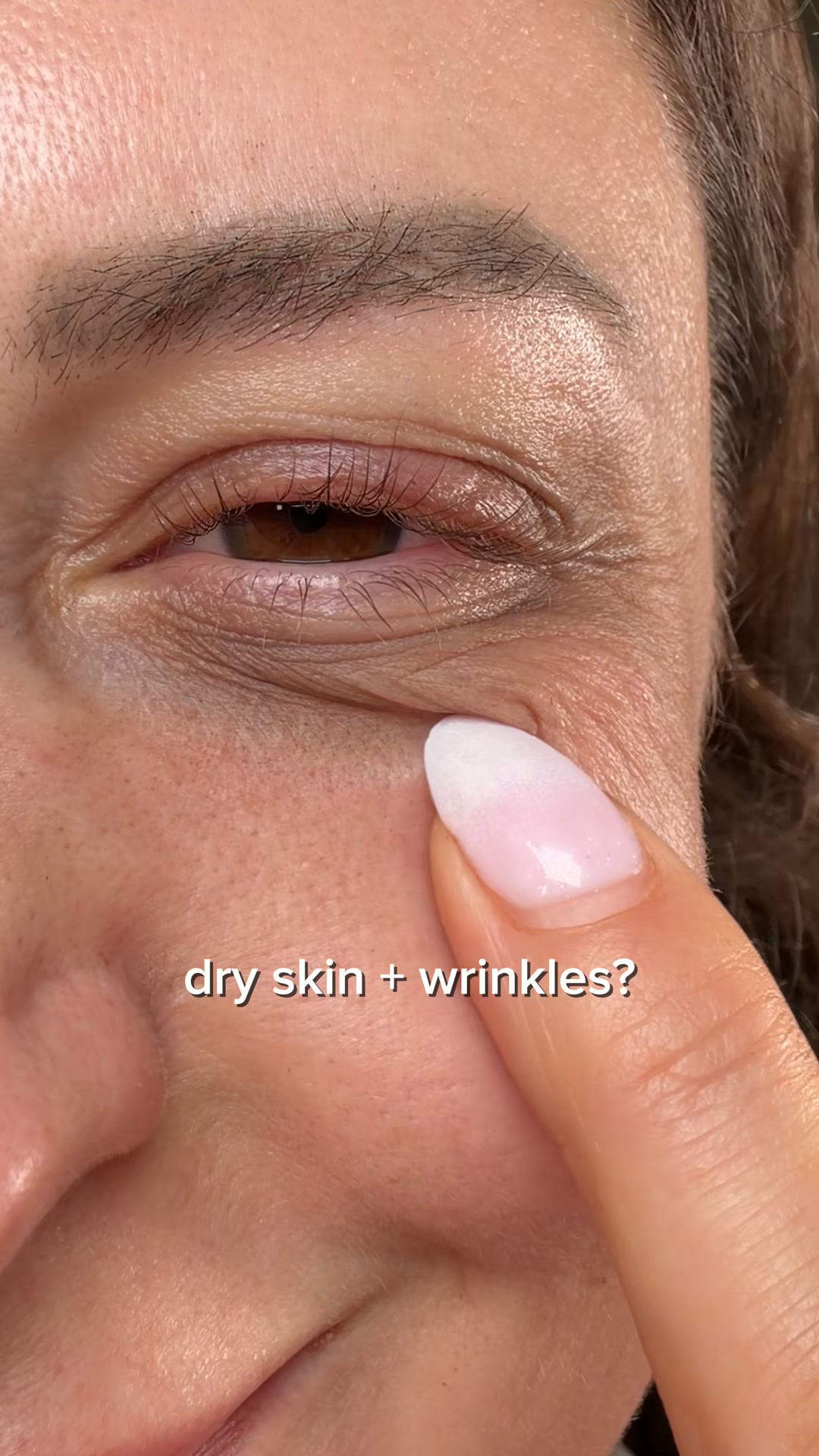 Dry Skin Making Fine Lines Stand Out?