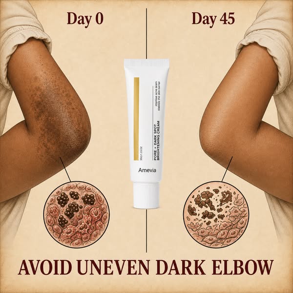 Dark Elbow Worst Ennemy | Fade in as little as 14 days