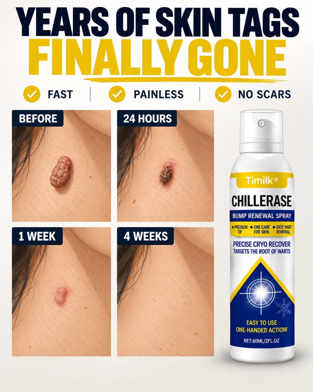 Fast & Easy Fix For Skin Tags