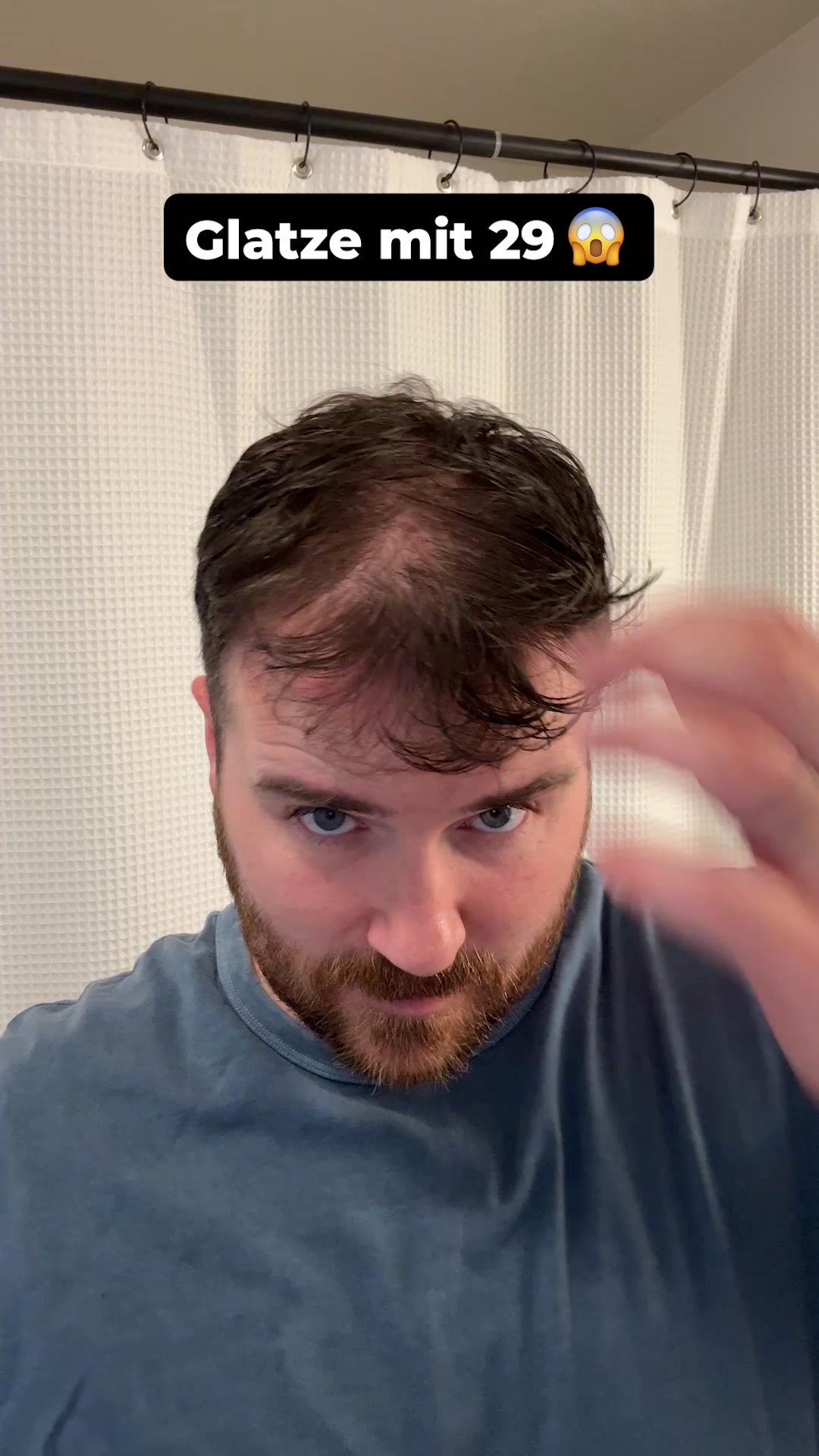 Volles Haar in 3-5 Wochen oder Geld zurück.