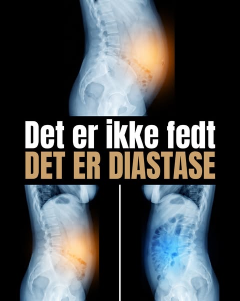 Derfor går maven ikke tilbage efter fødslen