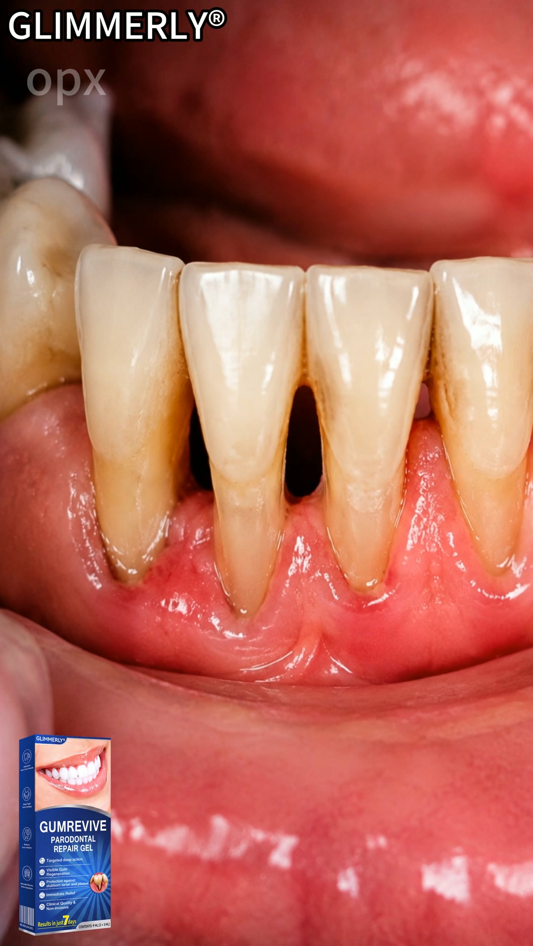 Wyprodukowano i wysłano w Polsce | Certyfikat CE | Potwierdzona skuteczność według norm Polskiego Towarzystwa Periodontologicznego