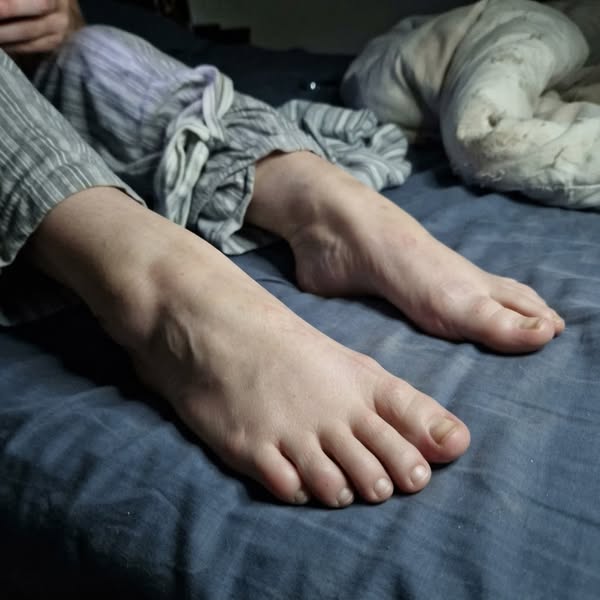 Fix Neuropathy Naturally