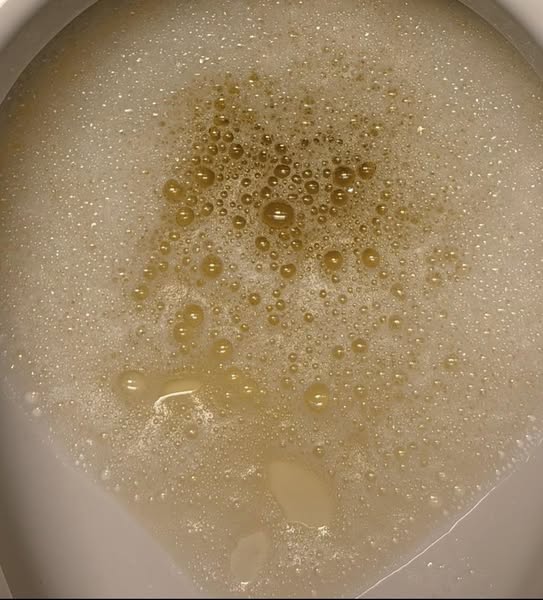 After menopause, bladder leakage isn't a muscle problem.