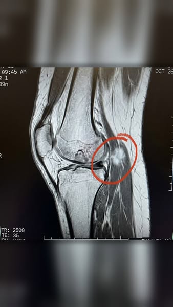 Everyone with joint issues needs to see this