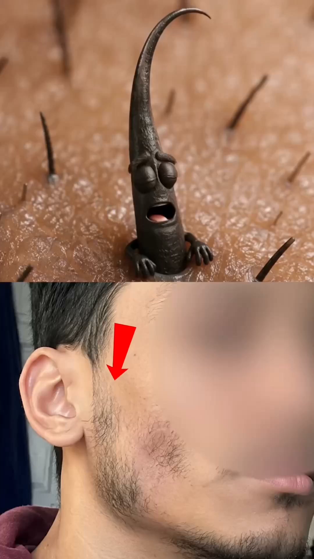 Patchy Beard? It's Not Genetics, It's The Product.