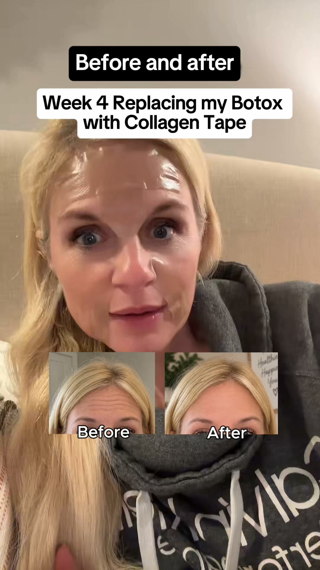 Celebrate Mom: 60% OFF Scarlette Collagen Tape (Limited Time)!