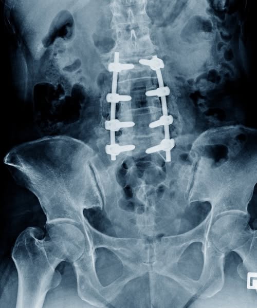What surgeons will NOT tell you