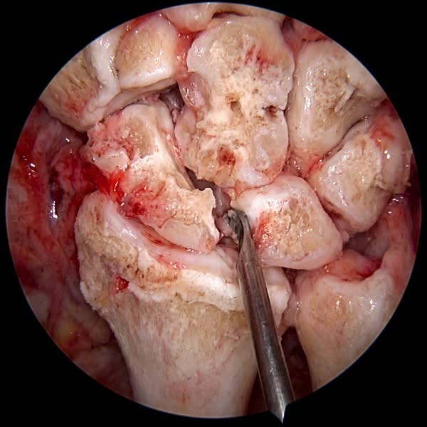 Lo que los traumatólogos no te dicen sobre el dolor de rodilla
