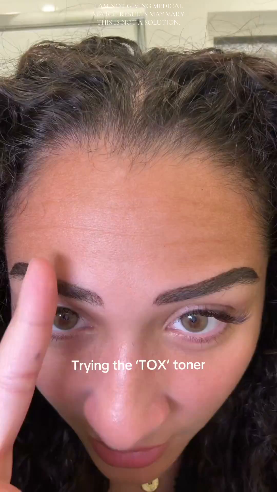 What This Does To Forehead Lines