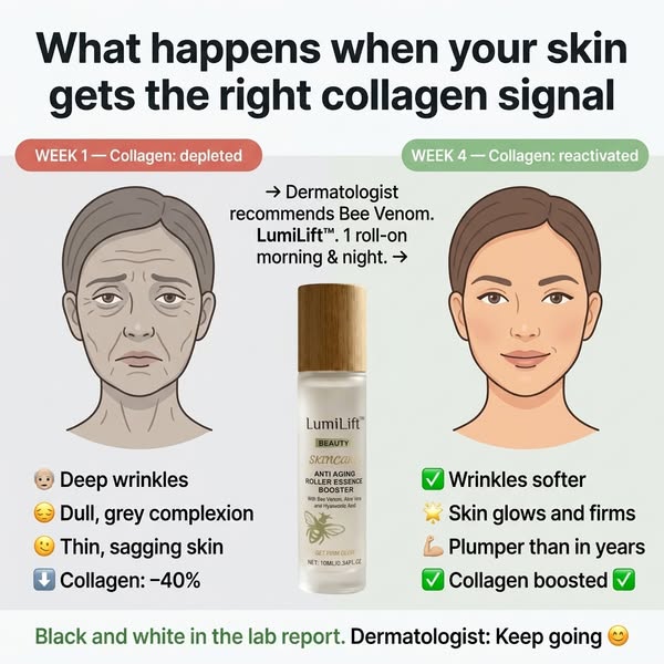 Deep wrinkles smoothed in 17 minutes