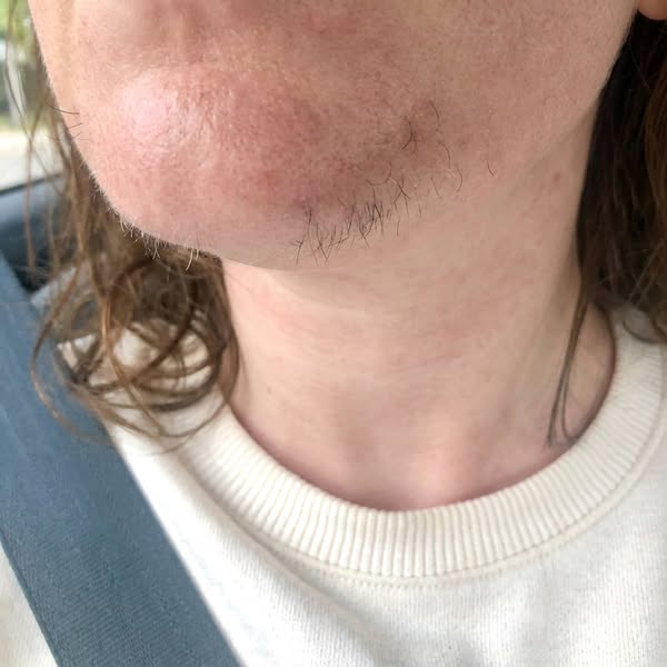 60-Year Old Wifes Who Still Pluck Their Chin Read This!