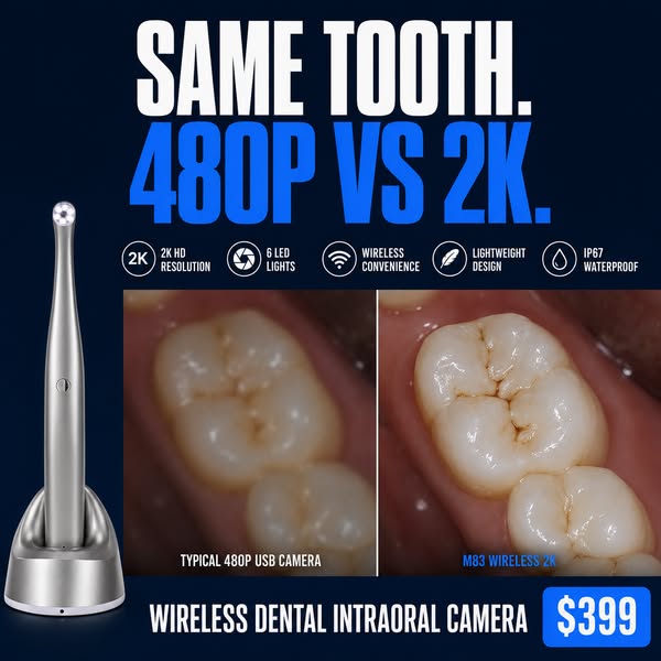 2K Wireless Dental Camera - $399, Not $2,500