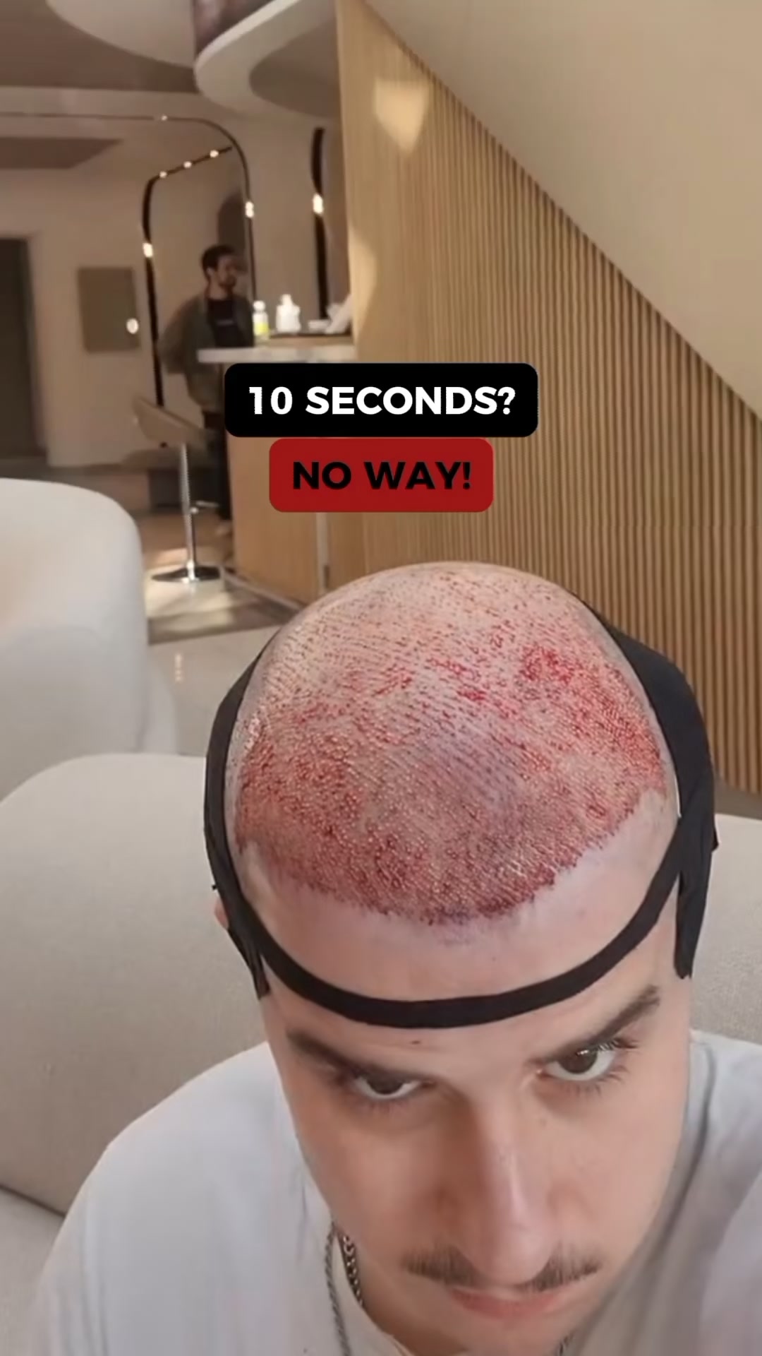 Beat Hair Loss Today