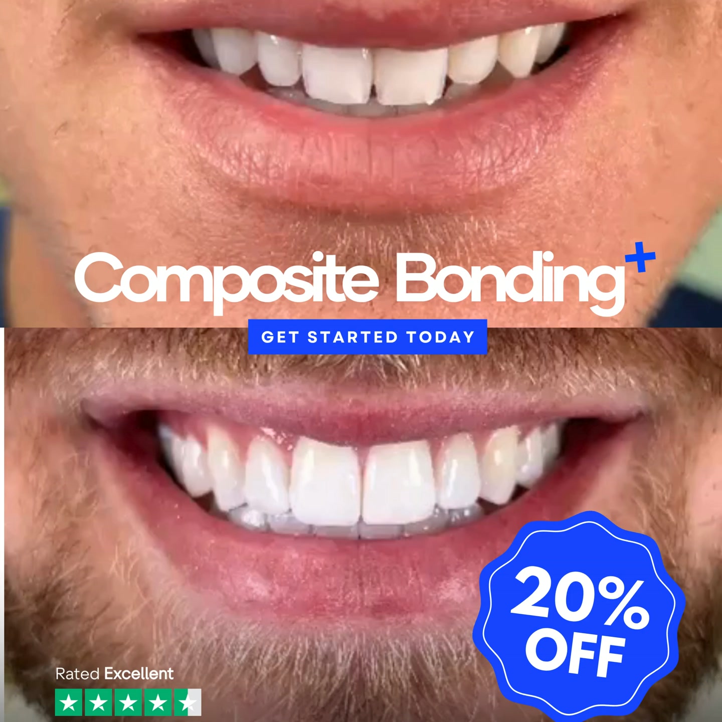 Book In Now For Your Summer Smile