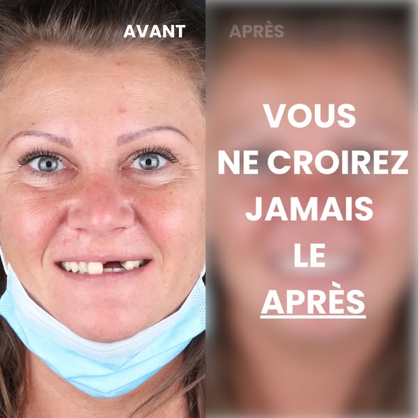 Le sourire parfait, sans dentiste