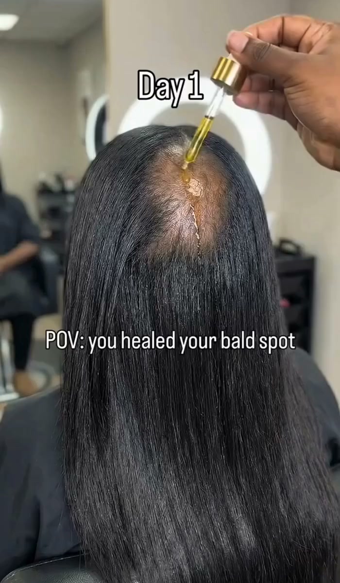 Cabello Más Abundante y Fuerte