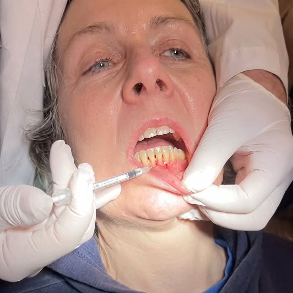 She flossed every day... her teeth came out anyway