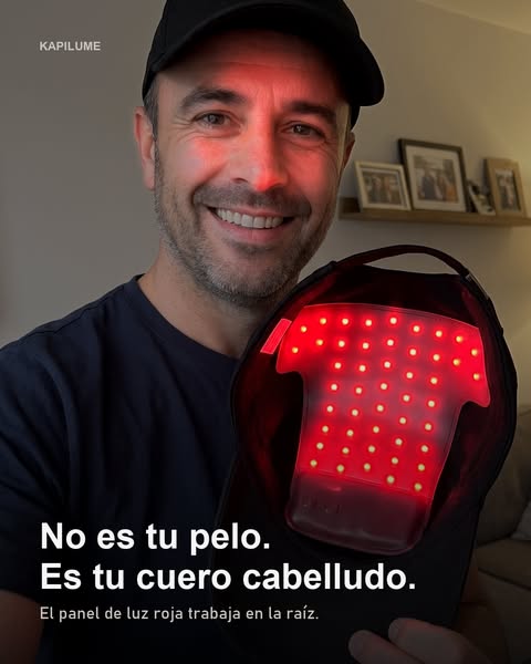 No es tu pelo. Es tu cuero cabelludo.